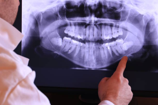 Best Chipped Tooth Repair Near Me  in Buellton, CA