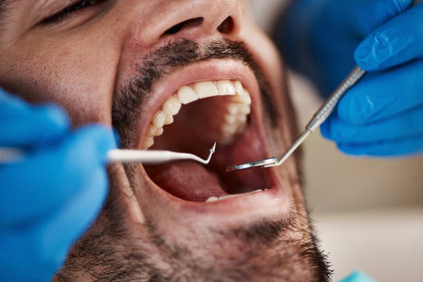 Best Dentist for Dental Trauma  in Buellton, CA