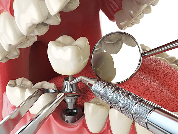 Best Urgent Tooth Repair  in Buellton, CA